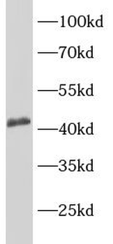 CCR2 Rabbit Polyclonal Antibody