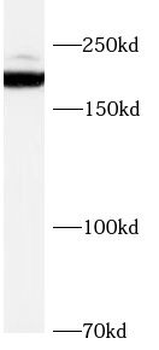SCN7A Rabbit Polyclonal Antibody
