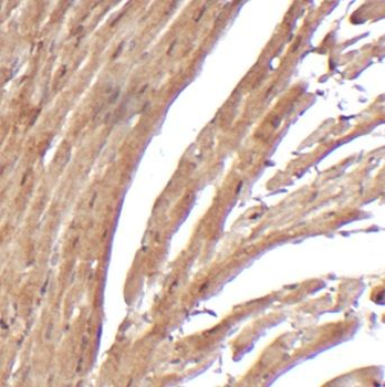 SCN7A Rabbit Polyclonal Antibody