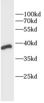 MTNR1A Rabbit Polyclonal Antibody