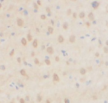 MTNR1A Rabbit Polyclonal Antibody