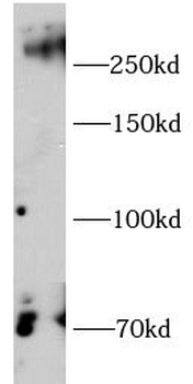 CSPG4 Rabbit Polyclonal Antibody