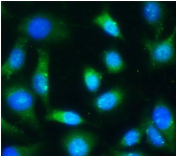 CSPG4 Rabbit Polyclonal Antibody