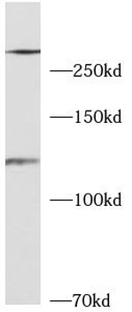 LRRK2 Rabbit Polyclonal Antibody