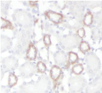 LRRK2 Rabbit Polyclonal Antibody