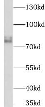 LOXL2 Rabbit Polyclonal Antibody