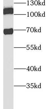 CHAF1B Rabbit Polyclonal Antibody