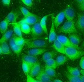 CHAF1B Rabbit Polyclonal Antibody
