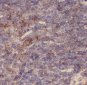 CHAF1B Rabbit Polyclonal Antibody