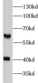 MMP16 Rabbit Polyclonal Antibody