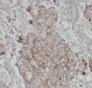 MMP16 Rabbit Polyclonal Antibody