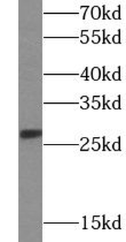 CD137 Rabbit Polyclonal Antibody