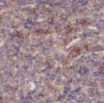 CD137 Rabbit Polyclonal Antibody