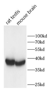 BIRC8 Rabbit Polyclonal Antibody
