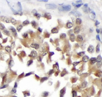 BIRC8 Rabbit Polyclonal Antibody