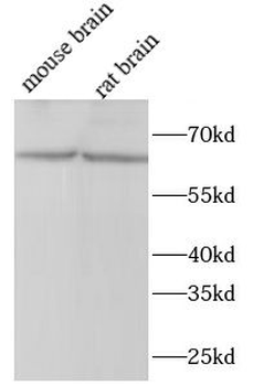 FOXO6 Rabbit Polyclonal Antibody