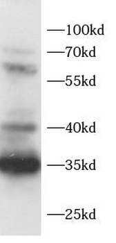 ADAM28 Rabbit Polyclonal Antibody