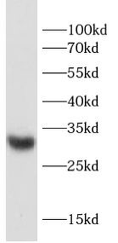 SDC4 Rabbit Polyclonal Antibody