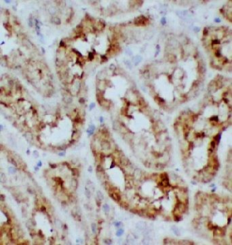 SDC4 Rabbit Polyclonal Antibody