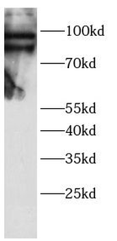 TAB3 Rabbit Polyclonal Antibody