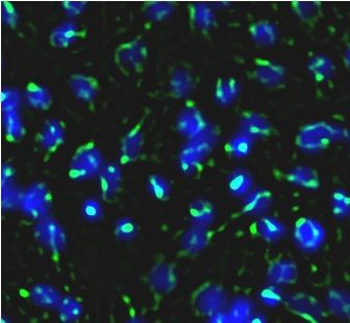 TAB3 Rabbit Polyclonal Antibody
