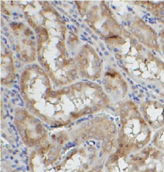 TAB3 Rabbit Polyclonal Antibody