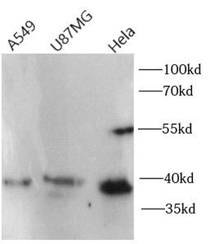 CXCR4 Rabbit Polyclonal Antibody