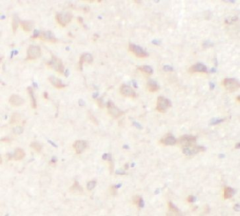 CXCR4 Rabbit Polyclonal Antibody