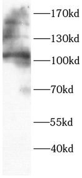 ADAM17 Rabbit Polyclonal Antibody