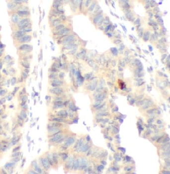 ADAM17 Rabbit Polyclonal Antibody