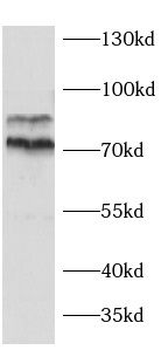 MTDH Rabbit Polyclonal Antibody