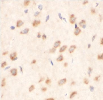 MTDH Rabbit Polyclonal Antibody