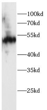 KRT7 Rabbit Polyclonal Antibody