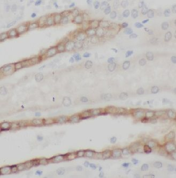 KRT7 Rabbit Polyclonal Antibody