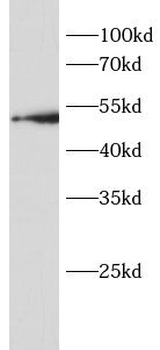 BACE1 Rabbit Polyclonal Antibody
