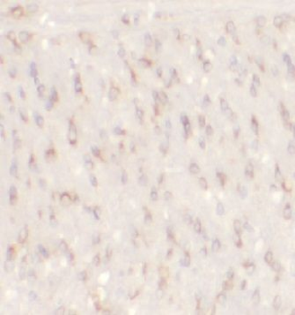 BACE1 Rabbit Polyclonal Antibody