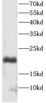 BAX Rabbit Polyclonal Antibody