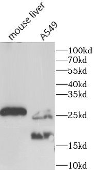 HSPB1 Rabbit Polyclonal Antibody