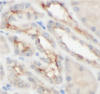 CAPRIN2 Rabbit Polyclonal Antibody