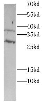 MLST8 Rabbit Polyclonal Antibody