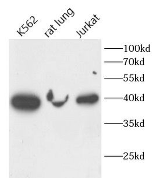 FUT2 Rabbit Polyclonal Antibody