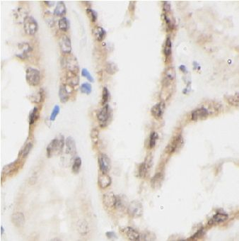 CD40LG Rabbit Polyclonal Antibody