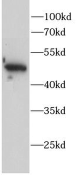 AP2M1 Rabbit Polyclonal Antibody