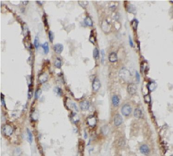 AP2M1 Rabbit Polyclonal Antibody