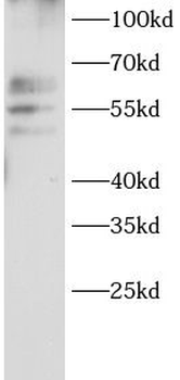 ABCE1 Rabbit Polyclonal Antibody