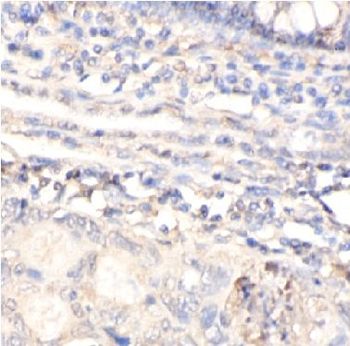 ABCE1 Rabbit Polyclonal Antibody