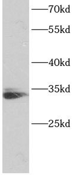 TNFRSF6B Rabbit Polyclonal Antibody