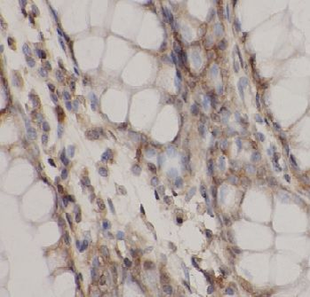 TNFRSF6B Rabbit Polyclonal Antibody