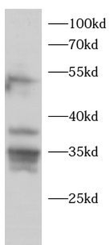 MAPK14 Rabbit Polyclonal Antibody