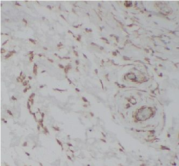 MAPK14 Rabbit Polyclonal Antibody